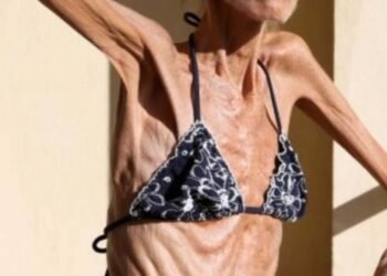 The Silent Struggle: Valeria Levitin’s Fight for Life and Awareness