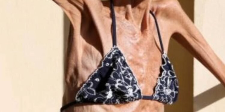 The Silent Struggle: Valeria Levitin’s Fight for Life and Awareness