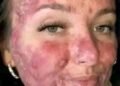 Her body was itchy, he thought it was an allergy