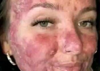 Her body was itchy, he thought it was an allergy