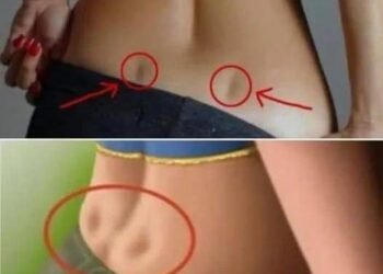 Uncategorized What Those Two Dips on Your Lower Back Are Commonly Called