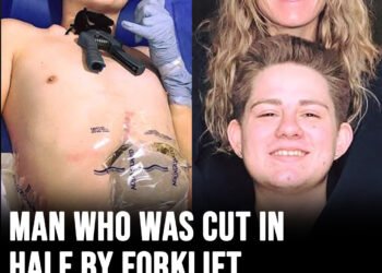 19-year-old crushed by forklift chooses to amputate bottom half of his body
