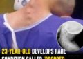 23-year-old develops rare condition called ‘dropped head syndrome’