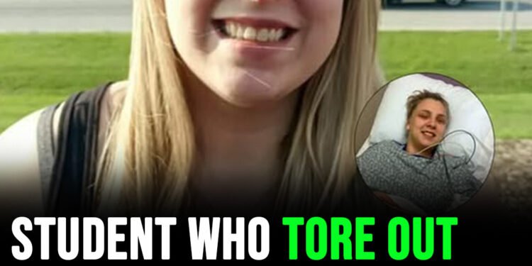 Student who tore out own eyeballs while high is fired from her job