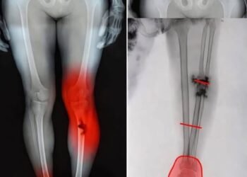 HT17. COVID-19 vaccinated individuals may be ill…See more