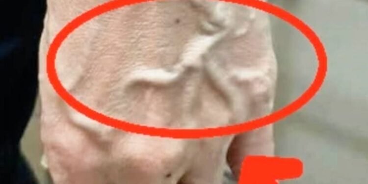 If Someone Has Visible Veins, Does It Mean Their Circulation Is Poor?