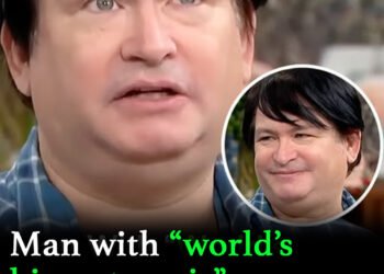 Man with world’s biggest p***s claims many A-list hookups
