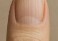 What Those Vertical Lines on Your Nails May Actually Mean as You Get Older