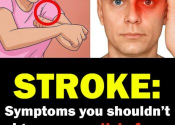 ONE MONTH BEFORE A STROKE, YOUR BODY MAY SEND THESE WA:RNING SIGNS — AND THEY CAN BE DIFFERENT FOR MEN AND WOMEN