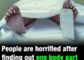People are horrified after finding out one body part is always removed during an autopsy