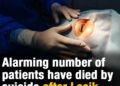 Alarming number of patients have died by suicide after Lasik eye surgery