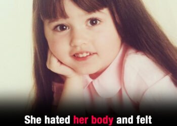 She hated her body and felt ‘ugly’ – at 32, she’s a super star, but still gets mocked for her teeth