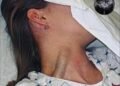 14-year-old teenager passed away after putting lamp on her pu…