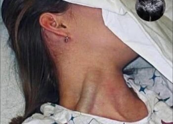 14-year-old teenager passed away after putting lamp on her pu…