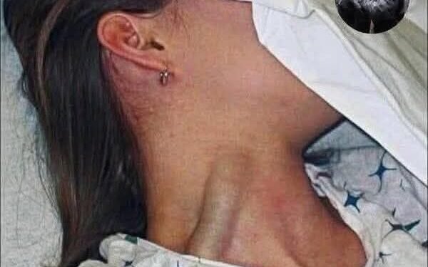 14-year-old teenager passed away after putting lamp on her pu…