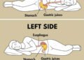 Researchers confirm: This is why you should never sleep on the right side of your body