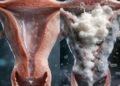 HIDDEN RISKS: EVERYDAY MALE BEHAVIORS THAT CAN AFFECT A WOMAN’S INTIMATE WELL-BEING