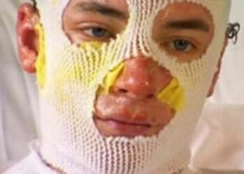 Uncle left with third-degree burns after running into burning building to save 8-year-old girl