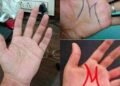 What Does an “M” on Your Palm Mean? The Popular Palmistry Symbol Explained