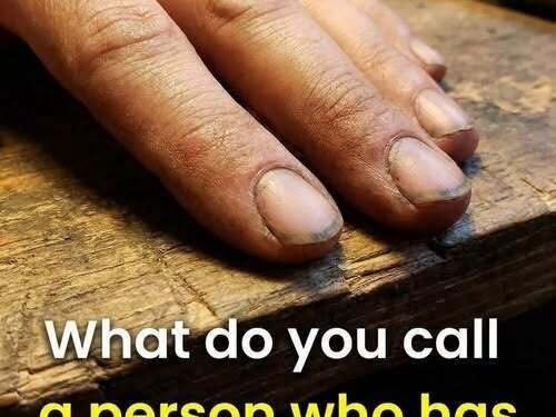 Before You Judge: What Dirty Nails Might Actually Mean