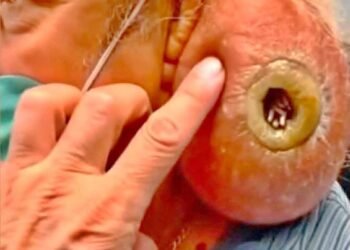 What Was Growing On His Ear?