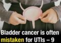 Bladder cancer is often mistaken for UTIs – 9 subtle symptoms you should never ignore
