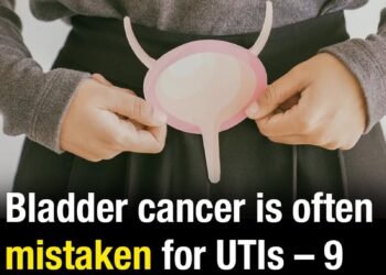 Bladder cancer is often mistaken for UTIs – 9 subtle symptoms you should never ignore