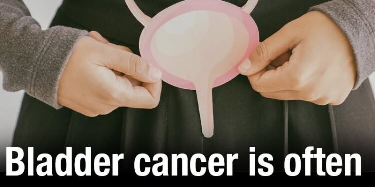 Bladder cancer is often mistaken for UTIs – 9 subtle symptoms you should never ignore