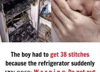 The boy had to get 38 stitches because the refrigerator suddenly ᴇxᴘʟᴏᴅᴇᴅ: W.a.r.n.i.n.g: Do not put these things in the freezer
