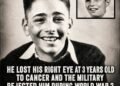He Lost His Right Eye At 3-Years-Old To Cancer But Went On To Become A Celebrated Actor