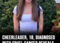 Teenage cheerleader symptoms ignored – diagnosed with cancer