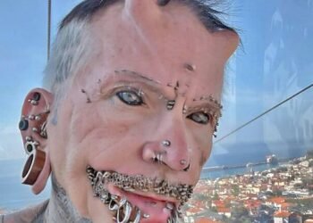 A man with 560 piercings, countless tattoos, and forehead implants – this is how he looked before