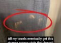 Why Mysterious Orange or Bleached-Looking Stains Keep Appearing on Your Towels, What Everyday Skincare Ingredients Like Benzoyl Peroxide Are Really Doing to Your Fabrics, and the Simple, Practical Ways You Can Prevent, Fix, and Stop Ruining Your Towels Without Giving Up Your Acne Routine