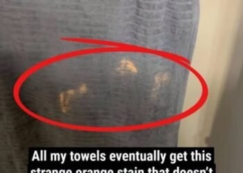 Why Mysterious Orange or Bleached-Looking Stains Keep Appearing on Your Towels, What Everyday Skincare Ingredients Like Benzoyl Peroxide Are Really Doing to Your Fabrics, and the Simple, Practical Ways You Can Prevent, Fix, and Stop Ruining Your Towels Without Giving Up Your Acne Routine