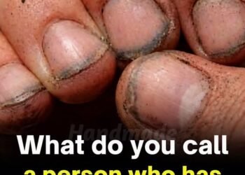 What Dirty Fingernails Really Reveal