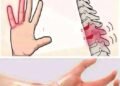 Reasons why you might be waking up with tingling hands