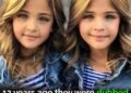 They called them the world’s most beautiful twins 10 years ago – but now look what the girls look like today