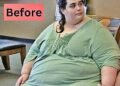 Woman Who Once Weighed 700 Pounds Transforms Her Life and Inspires Others