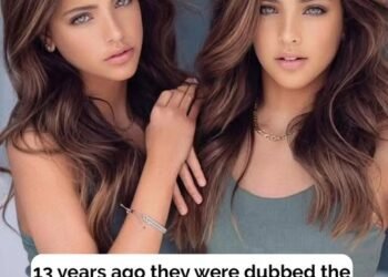 ‘Most beautiful twins in the world’ are now stunning young teens