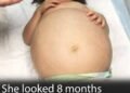 Little girl gets life-saving kidney operation thanks to her dad