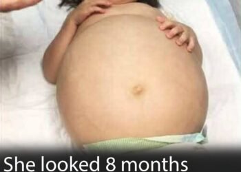 Little girl gets life-saving kidney operation thanks to her dad