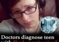 Doctors diagnose teen with constipation, dies 24 hours later