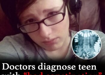 Doctors diagnose teen with constipation, dies 24 hours later