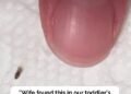 Head lice: How to get rid of them and stop them coming back