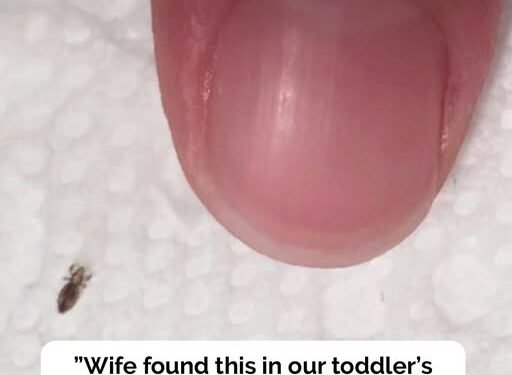 Head lice: How to get rid of them and stop them coming back
