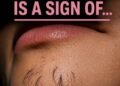 Why Chin Hair Grows in Women and What It M