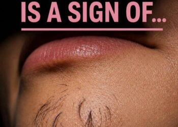 Why Chin Hair Grows in Women and What It M
