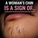 Why Chin Hair Grows in Women and What It M