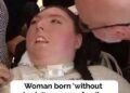 Woman born without brain turns 20, family calls her ‘miracle’