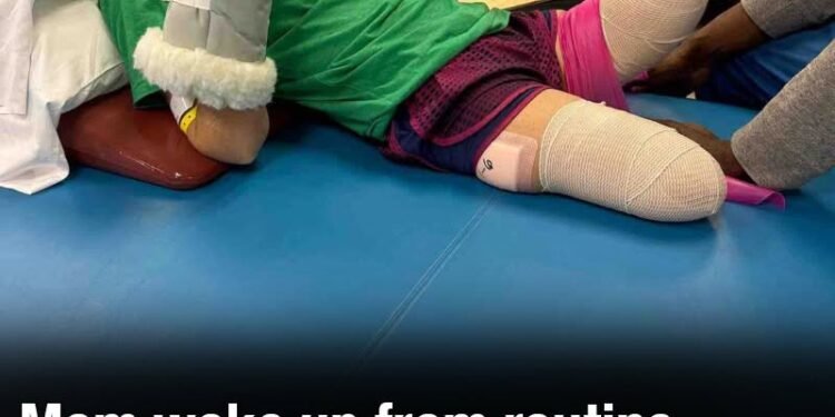 Mom woke up from routine surgery to discover all four limbs had been amputated